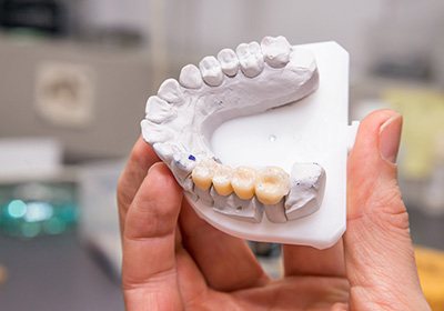 A dental bridge on a pale blue background