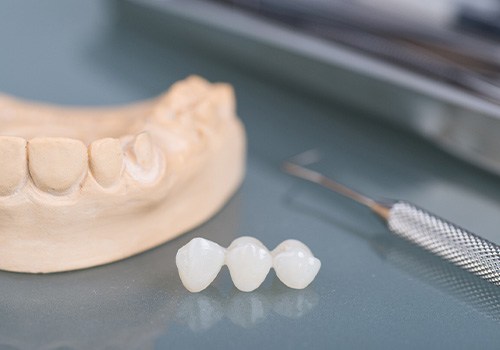 Dental bridge on reflective surface next to dental instruments and model teeth