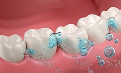 Illustration of fluoride on teeth
