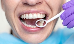Close up of dental mirror and a patient’s teeth