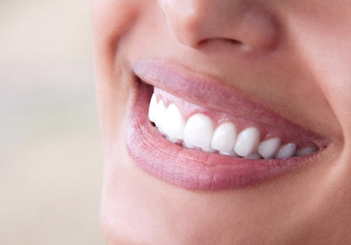 Closeup of beautiful smile thanks to teeth whitening in San Antonio