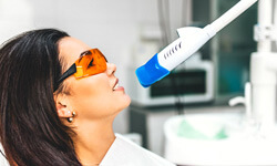 woman receiving professional teeth whitening in san antonio tx