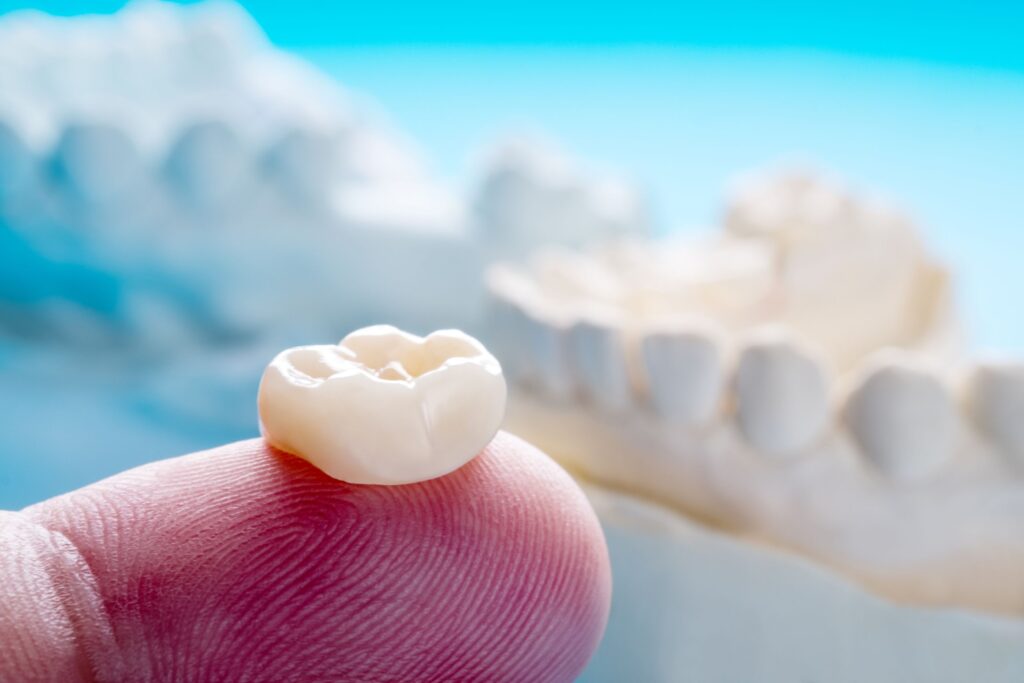 Dental crown on someone's fingertip