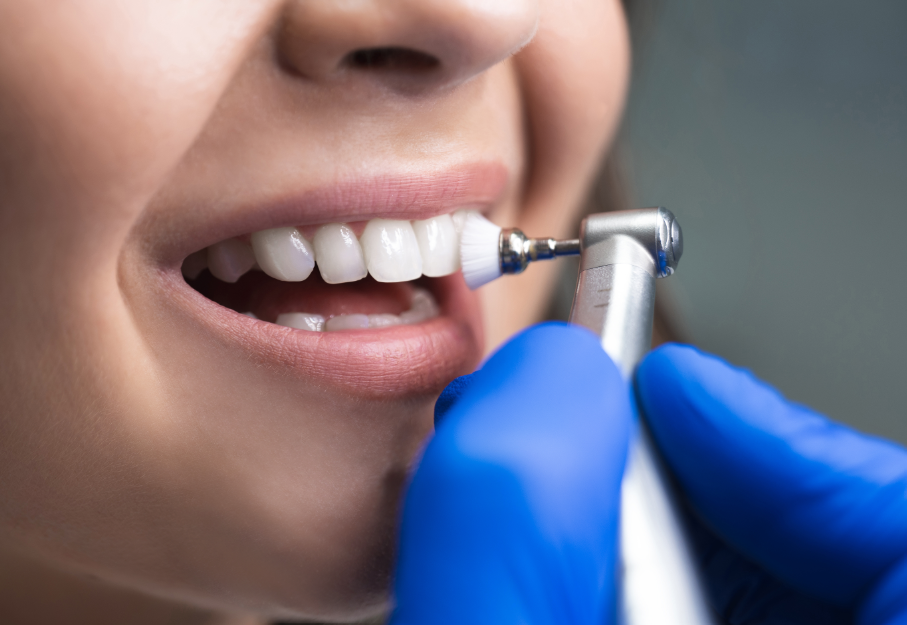 Close up of woman's teeth being polished
